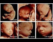 Non-Invasive Procedure